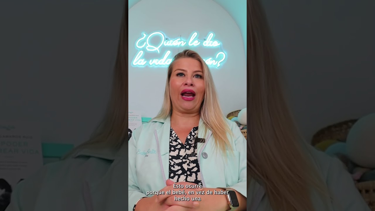 presentacion de cara en el parto