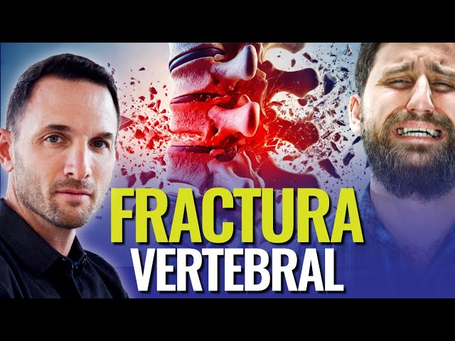 tiempo de baja por fractura vertebral