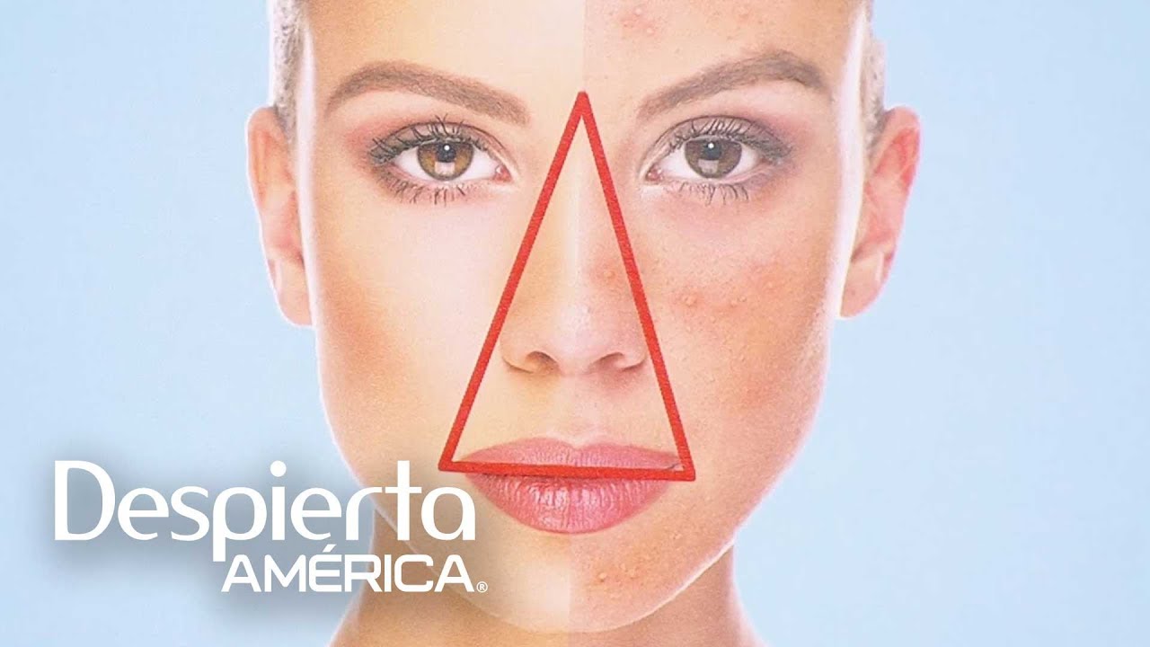 triangulo de la muerte en la cara anatomia